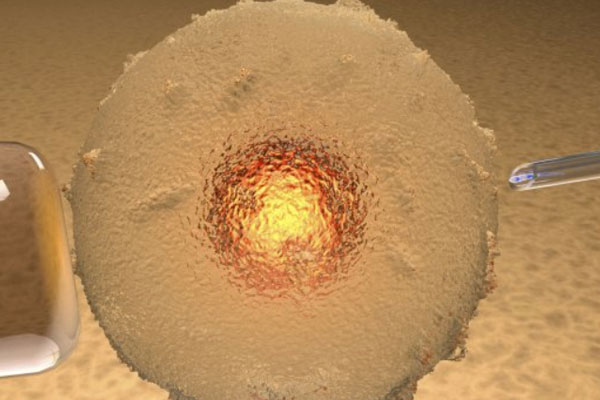 吉尔吉斯供卵代孕费用明细解读